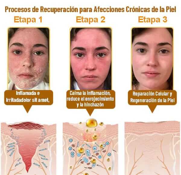 Crema reparadora de veneno de abeja 60g - Bee Venom