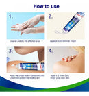 Removedor de Verrugas - additional image 2